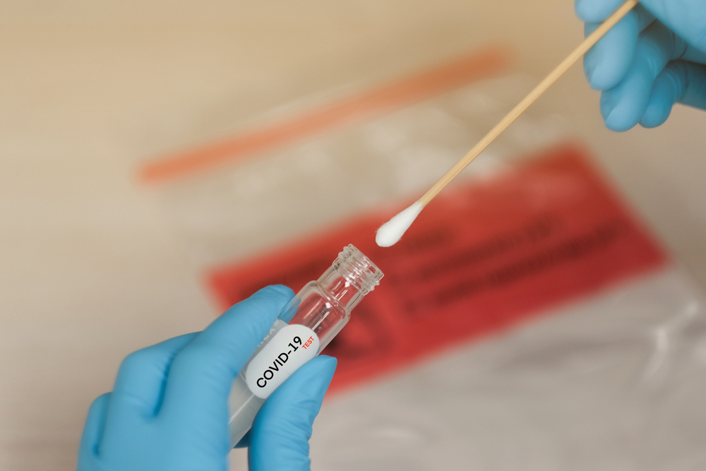 Infecção por Coronavírus (Covid-19)
