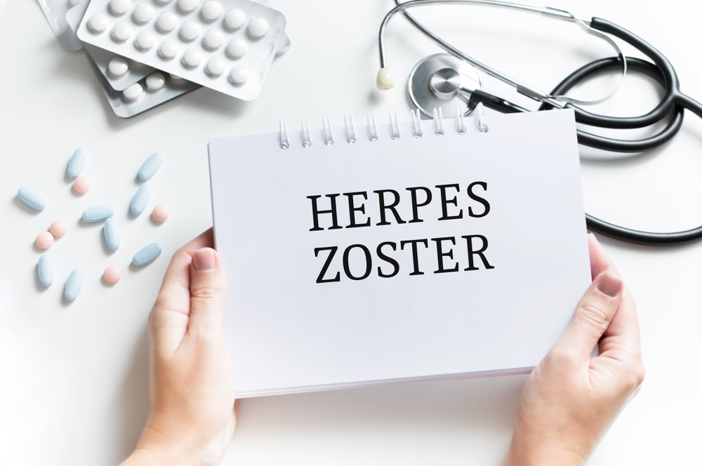 Sintomas de herpes zoster