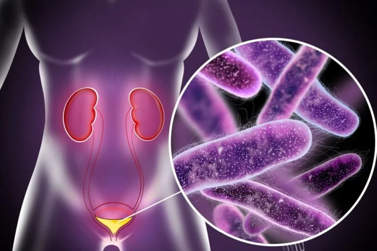 Imagem ilustrativa de bactérias em mulher após passar pela região dos rins.