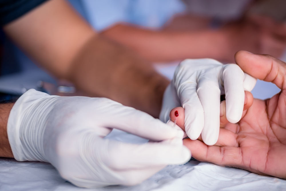 Teste de HIV: entenda como é feito e qual a importância