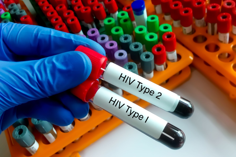 HIV 1 e 2: entenda o que são e principais diferenças