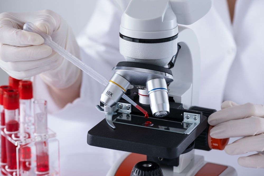 Diagnóstico de HIV: tudo o que você precisa saber sobre ele
