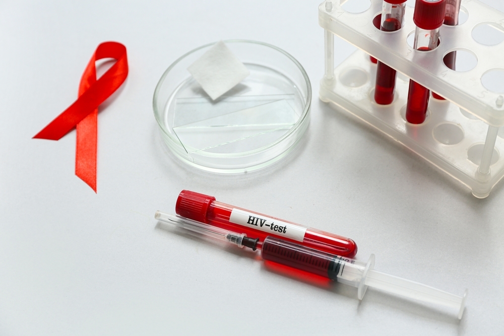Como saber se tenho HIV?