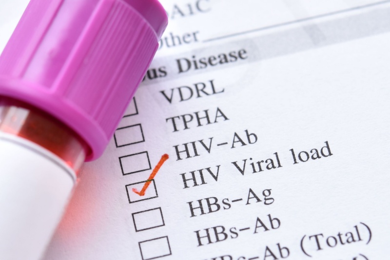 Carga viral do HIV: o que é, como é medida e por que é importante